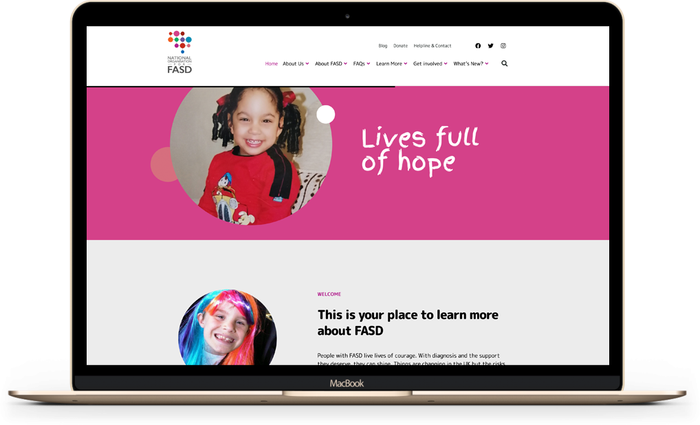 National FASD website