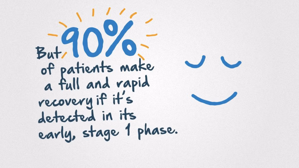 Digestive Cancers Europe animation 90%